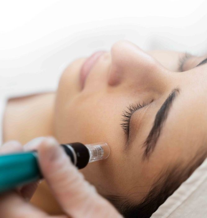 Derma pen microneedling for skin repair
