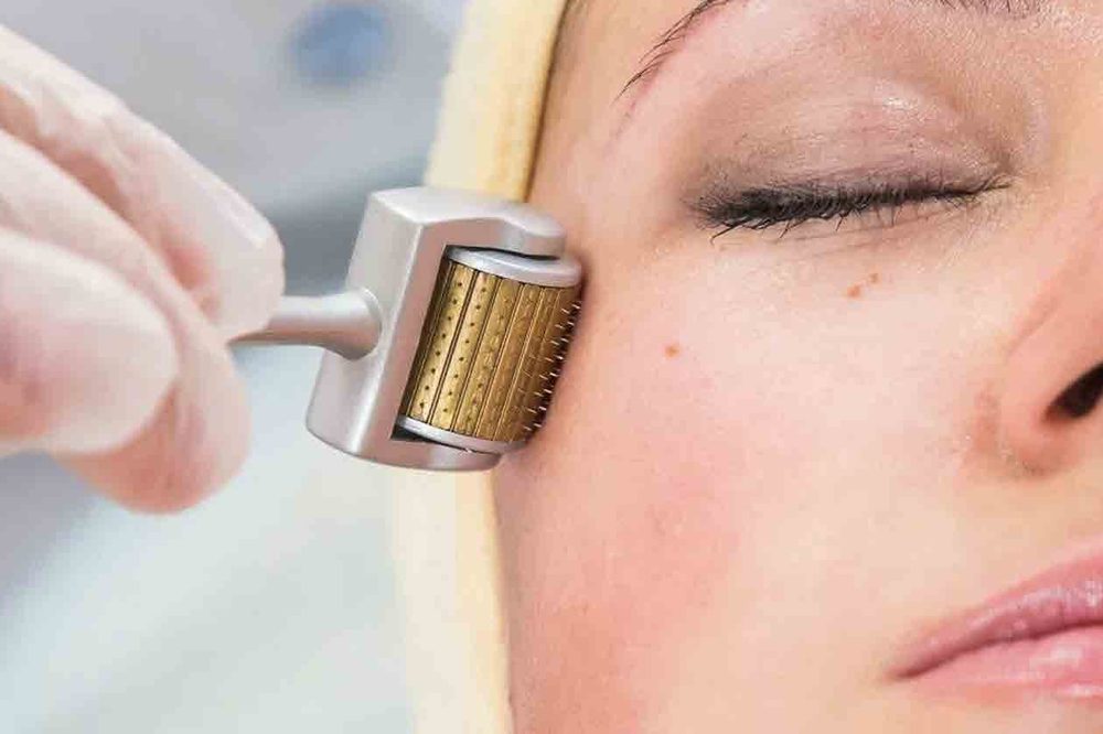 Micro derma skin treatment at Figure First